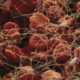 Blood Clot
