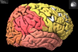 Computerized Picture of a Human Brain