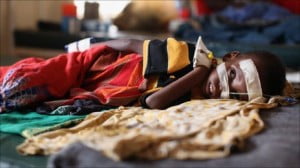 Miilions of Citizen in Somalia Affected by Drought