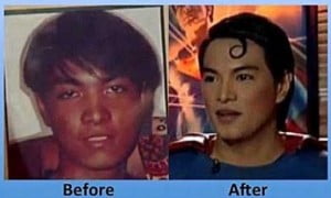 Herbert Chavez Filipino Superfan Making Surgeries Video Herbert Chavez superman of the philippines