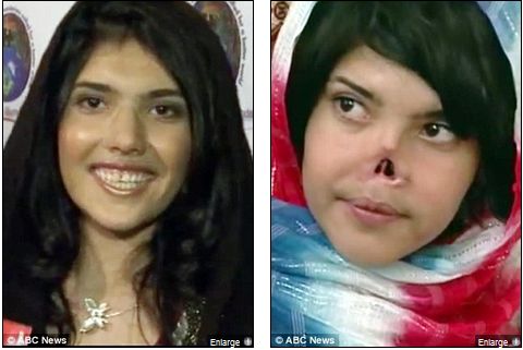 Aesha Mohammadzai: Inspirational Story of Taliban Woman Escaping Oppression Taliban Victim Granted Political Asylum