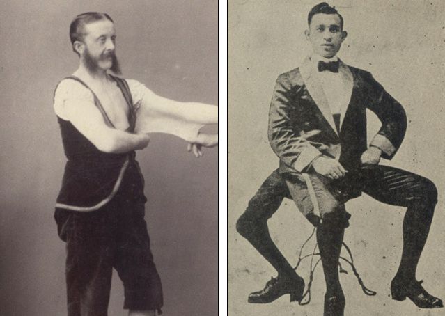 Elastic Man and 3 legged Man Circus Performers at 19th Century in New York (Photo)
